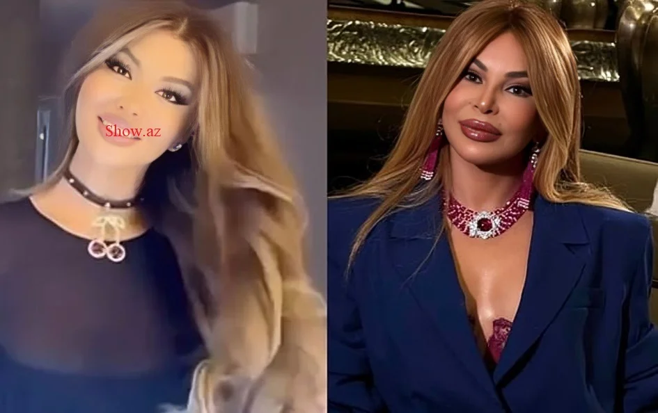 Estetik əməliyyat edən Aygün Kazımovanın qızı özünü anasına bənzətdi - Foto